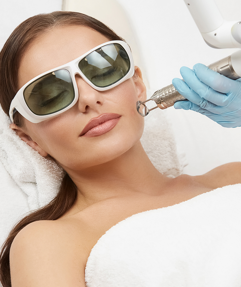 Co2 Fracionado Laser